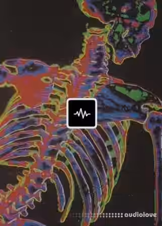 WavSupply Radioactive (Loop Kit) [WAV] - Sample Pack Artwork